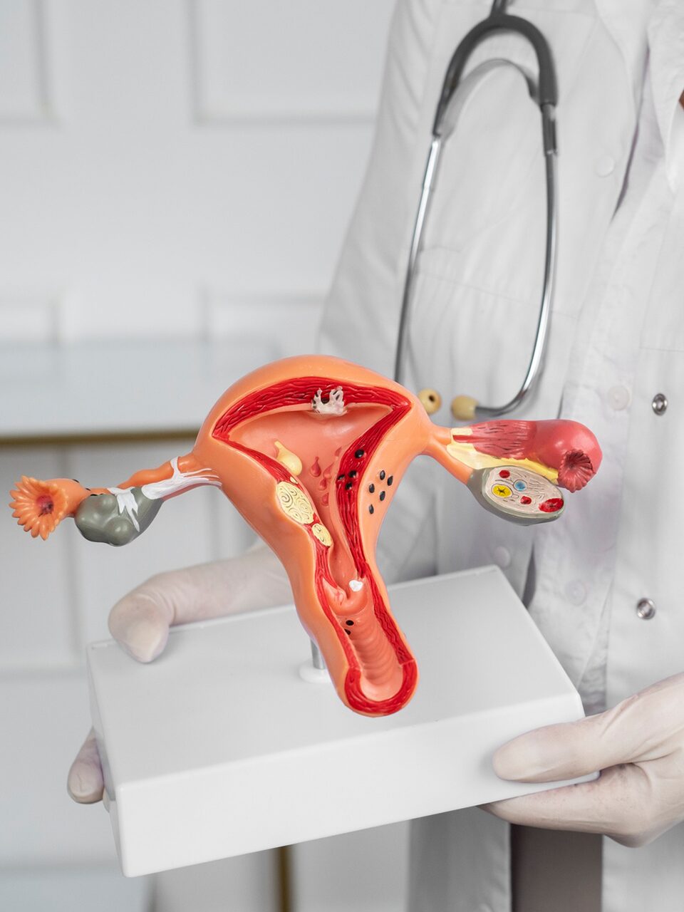 Dr Mario Haines | Uterine Fibroid Embolisation | Interventional Radiologist